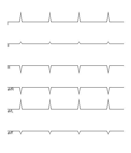 EKG zur Abfrage