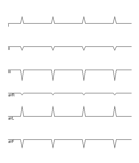 EKG zur Abfrage