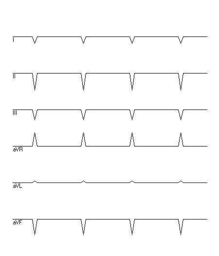 EKG zur Abfrage