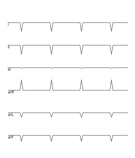 EKG zur Abfrage