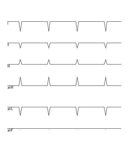 EKG zur Abfrage