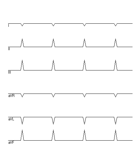 EKG zur Abfrage