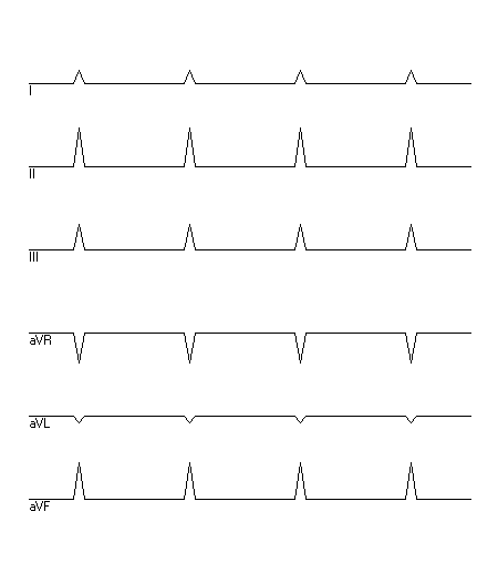 EKG zur Abfrage