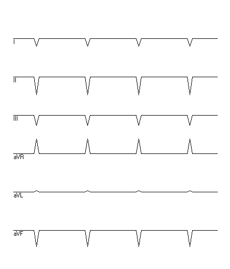 EKG zur Abfrage