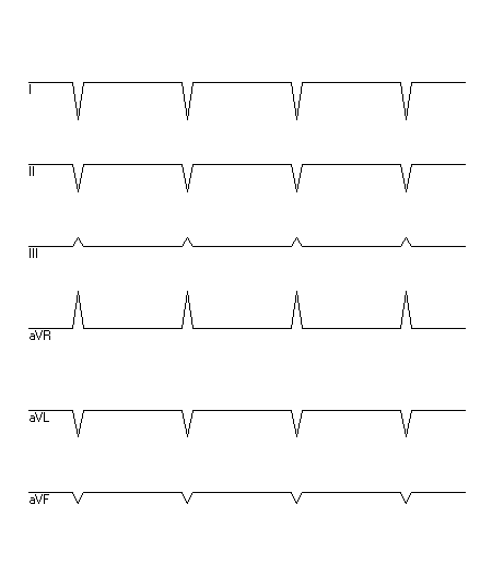 EKG zur Abfrage