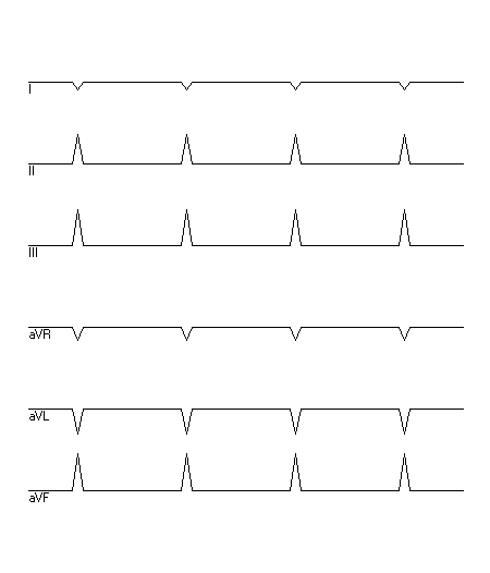 EKG zur Abfrage