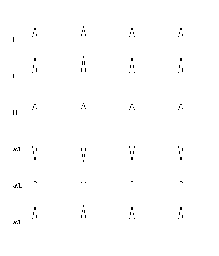 EKG zur Abfrage