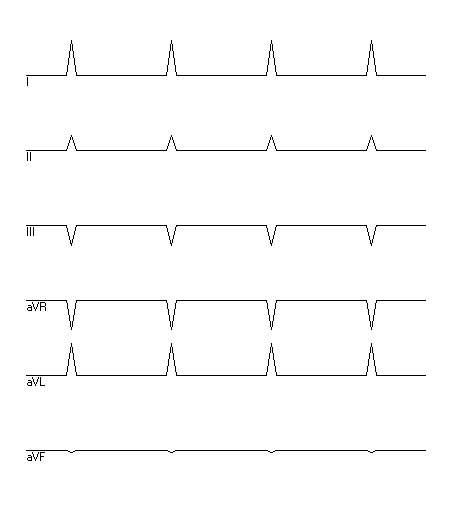 EKG zur Abfrage