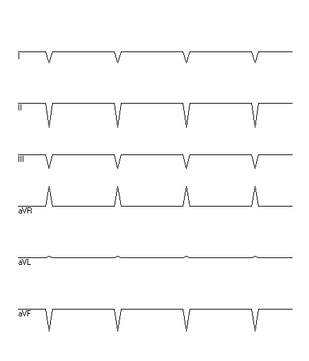 EKG zur Abfrage