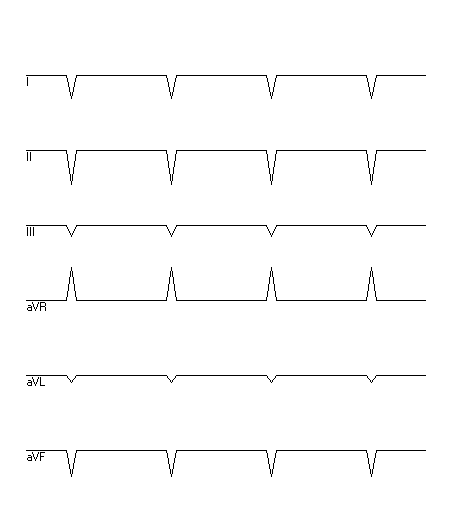 EKG zur Abfrage