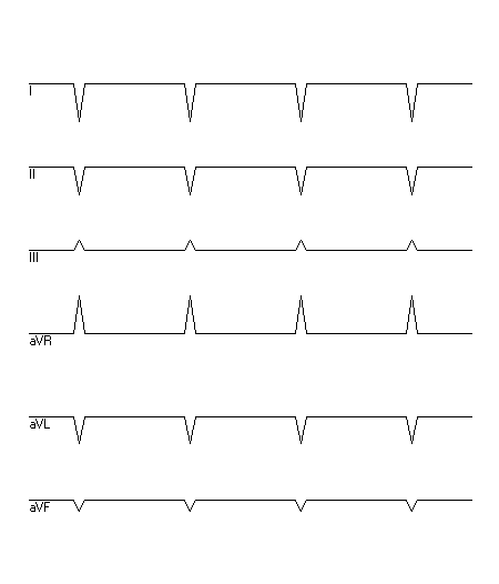 EKG zur Abfrage