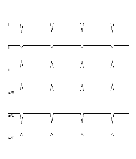 EKG zur Abfrage