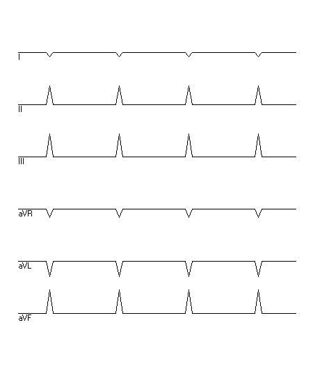 EKG zur Abfrage