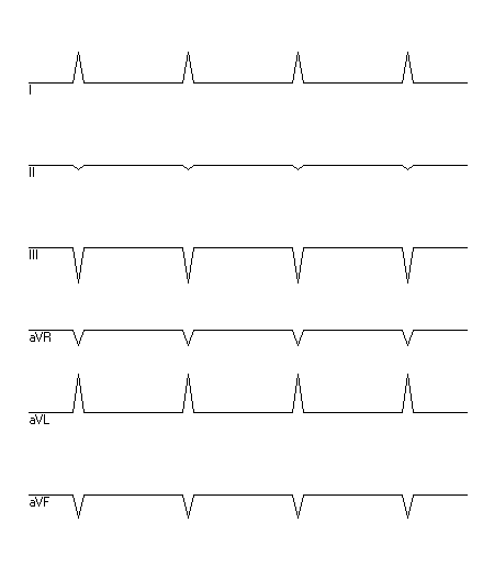 EKG zur Abfrage