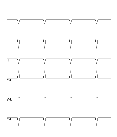 EKG zur Abfrage