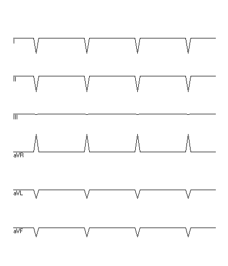 EKG zur Abfrage