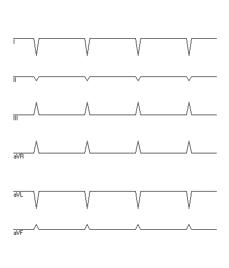 EKG zur Abfrage