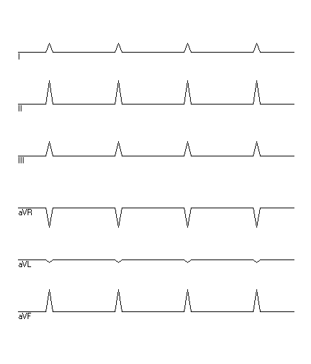 EKG zur Abfrage