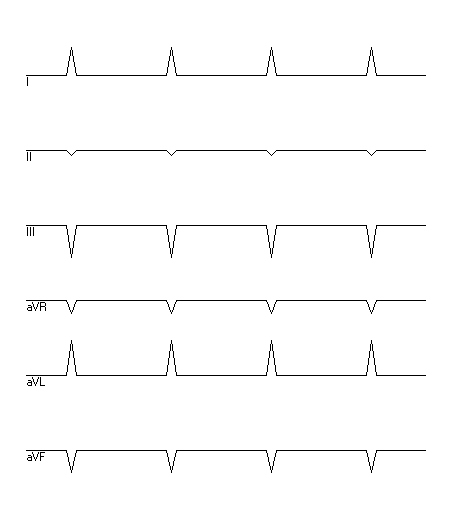 EKG zur Abfrage