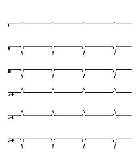 EKG zur Abfrage