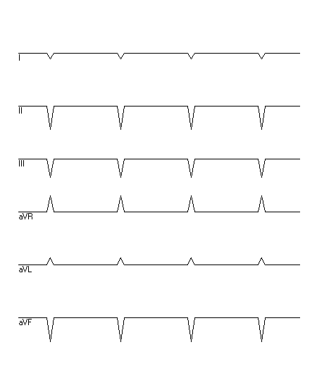 EKG zur Abfrage