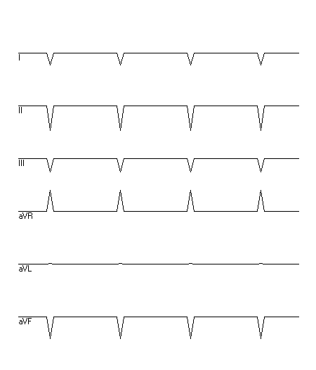 EKG zur Abfrage