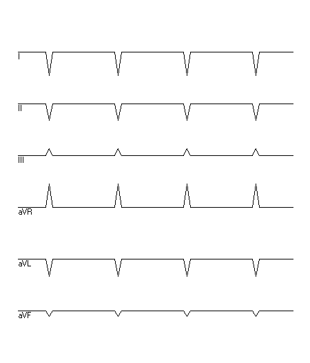 EKG zur Abfrage