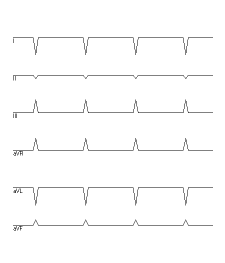 EKG zur Abfrage