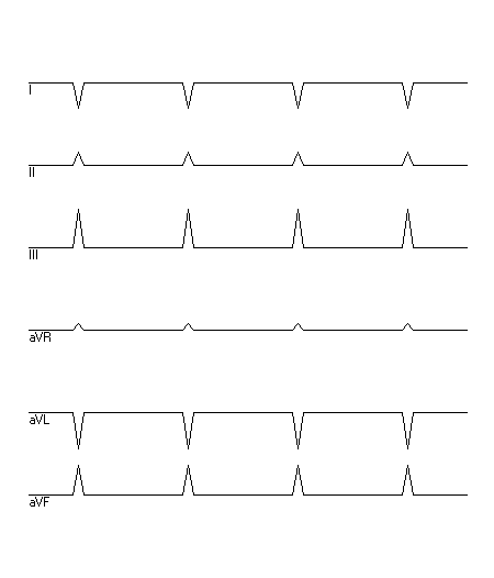 EKG zur Abfrage