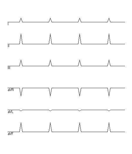 EKG zur Abfrage