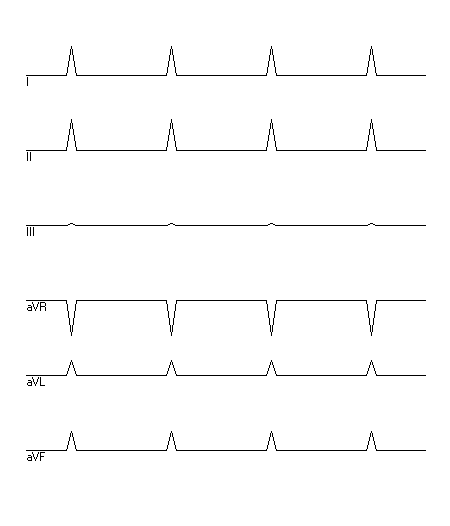 EKG zur Abfrage