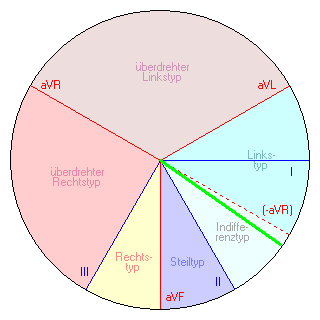 Vektor im Cabrera-Kreis