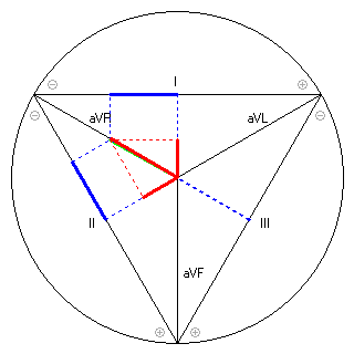 Vektor im Einthoven-Dreieck