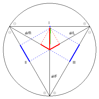 Vektor im Einthoven-Dreieck