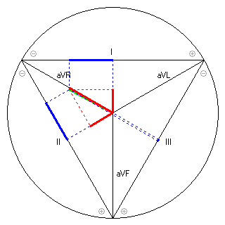 Vektor im Einthoven-Dreieck