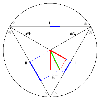 Vektor im Einthoven-Dreieck