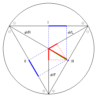 Vektor im Einthoven-Dreieck