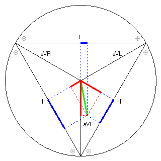 Vektor im Einthoven-Dreieck