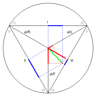 Vektor im Einthoven-Dreieck