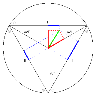 Vektor im Einthoven-Dreieck