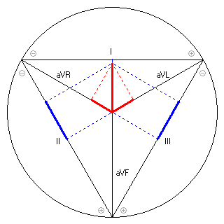 Vektor im Einthoven-Dreieck