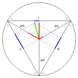 Vektor im Einthoven-Dreieck