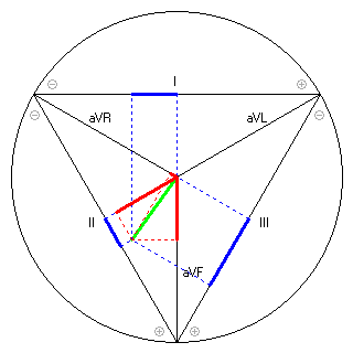 Vektor im Einthoven-Dreieck