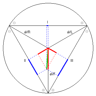 Vektor im Einthoven-Dreieck