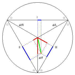 Vektor im Einthoven-Dreieck