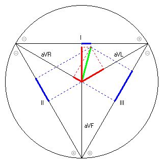 Vektor im Einthoven-Dreieck