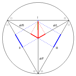 Vektor im Einthoven-Dreieck