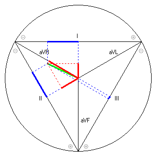 Vektor im Einthoven-Dreieck