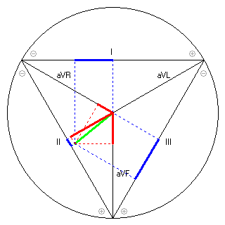 Vektor im Einthoven-Dreieck