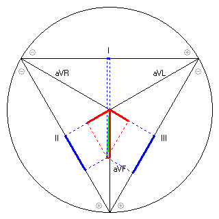 Vektor im Einthoven-Dreieck